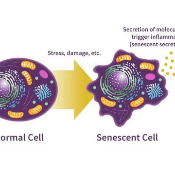 Parkinsons Recovery